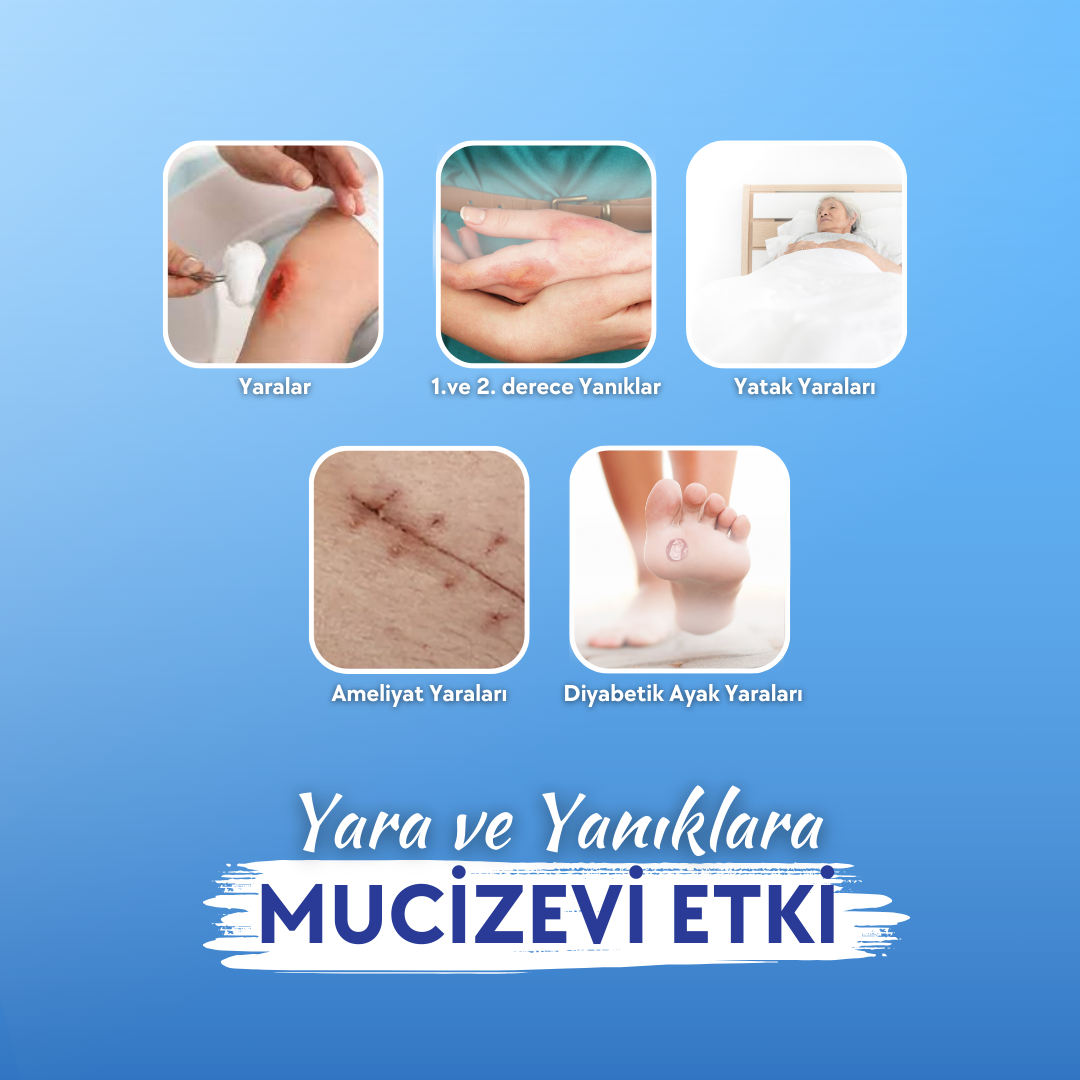 Actolind Solution Plus yanıklar, yatak yaraları, bası yaraları, ameliyat yaraları, diyabetik ayak yaraları, venöz yaralar, kronik yaralar için