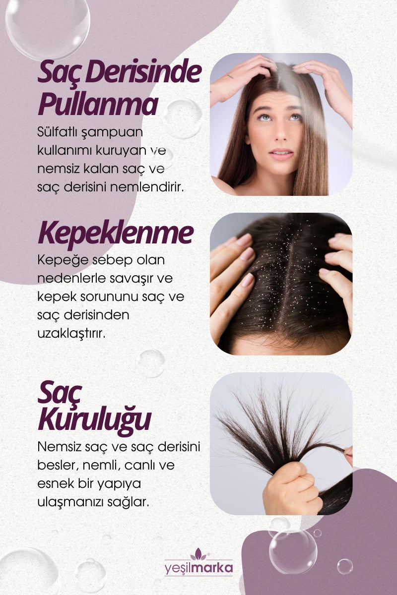 Kepek, pullanma ve kaşıntıya doğal çözüm. Yeşilmarka doğal kepek şampuanı.