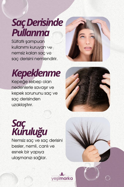 Kepek, pullanma ve kaşıntıya doğal çözüm. Yeşilmarka doğal kepek şampuanı. 